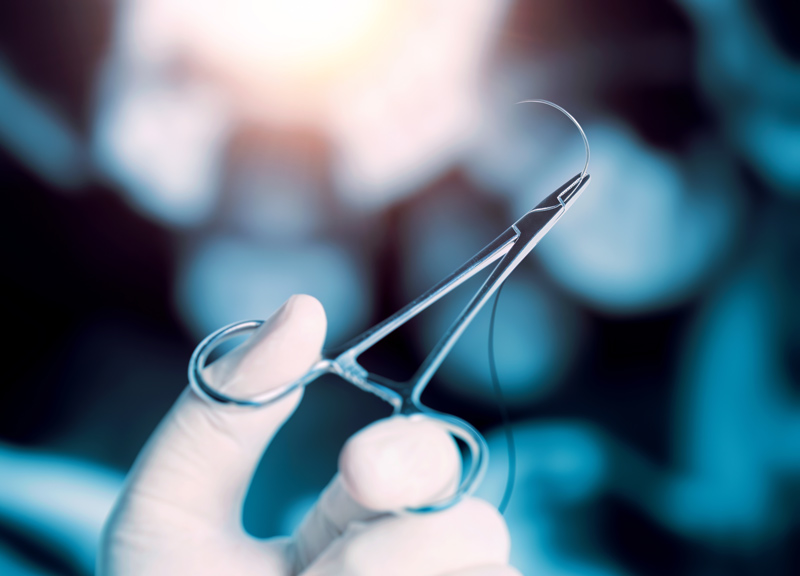 nylon sutures